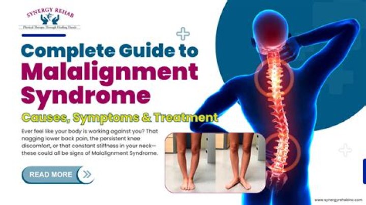 Is miserable malalignment syndrome rare?