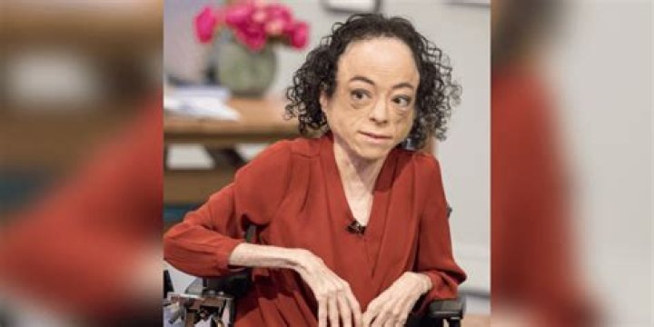 Liz Carr Bio (Wiki) 